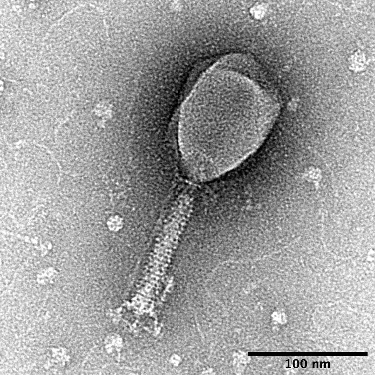 Anthropic's Claude Swarm Surfaces a Novel Phage Enzyme
